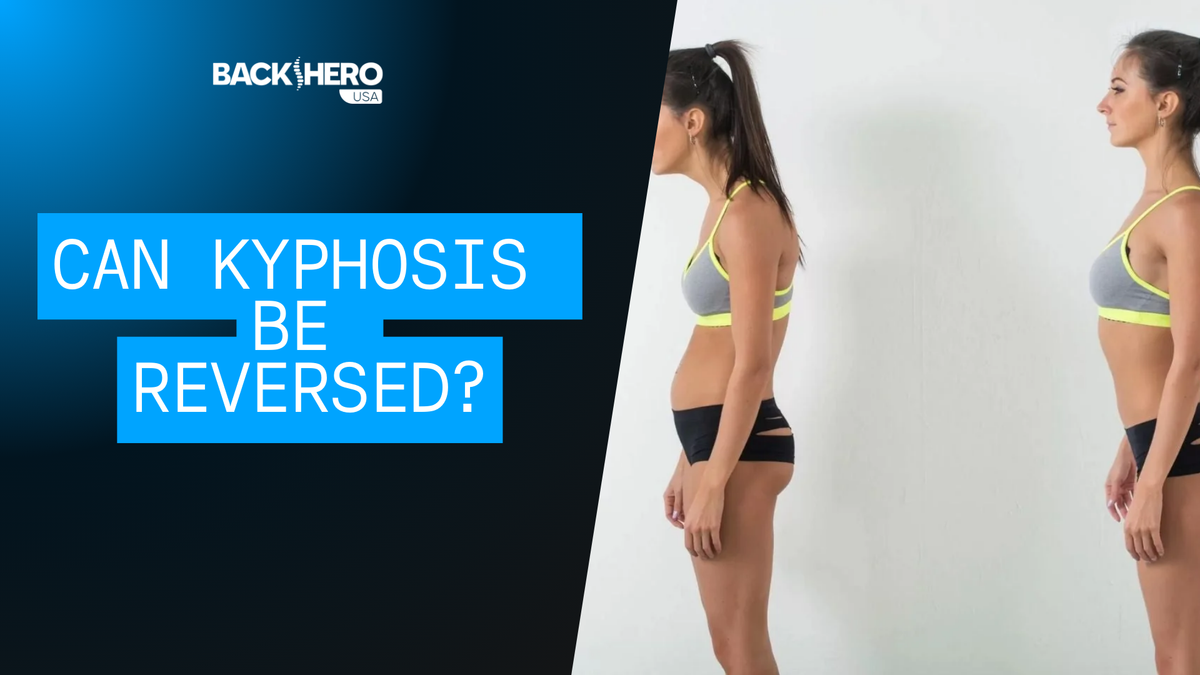 back-hero-usa-can-kyphosis-be-reversed