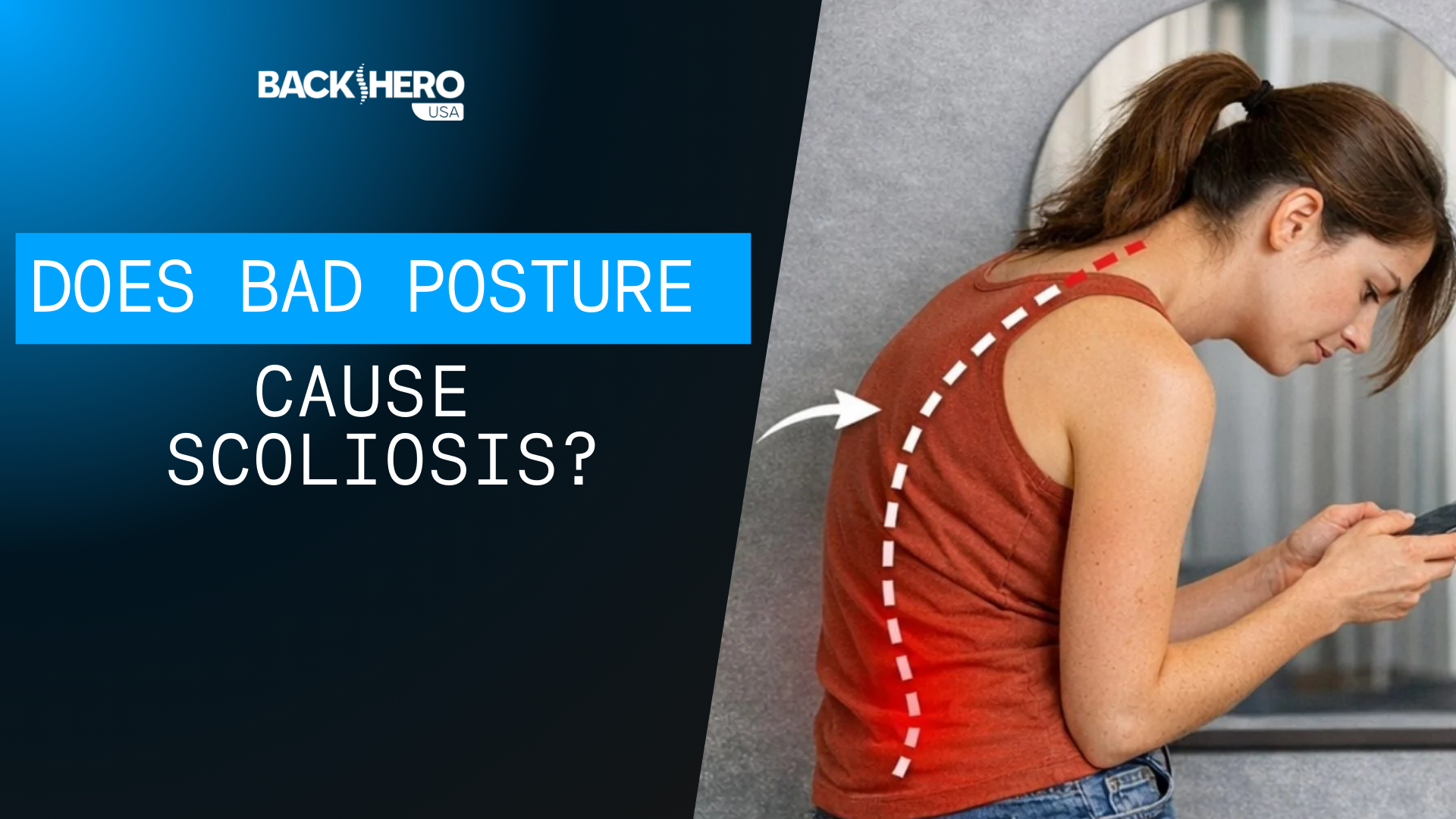 back-hero-usa-does-bad-posture-cause-scoliosis