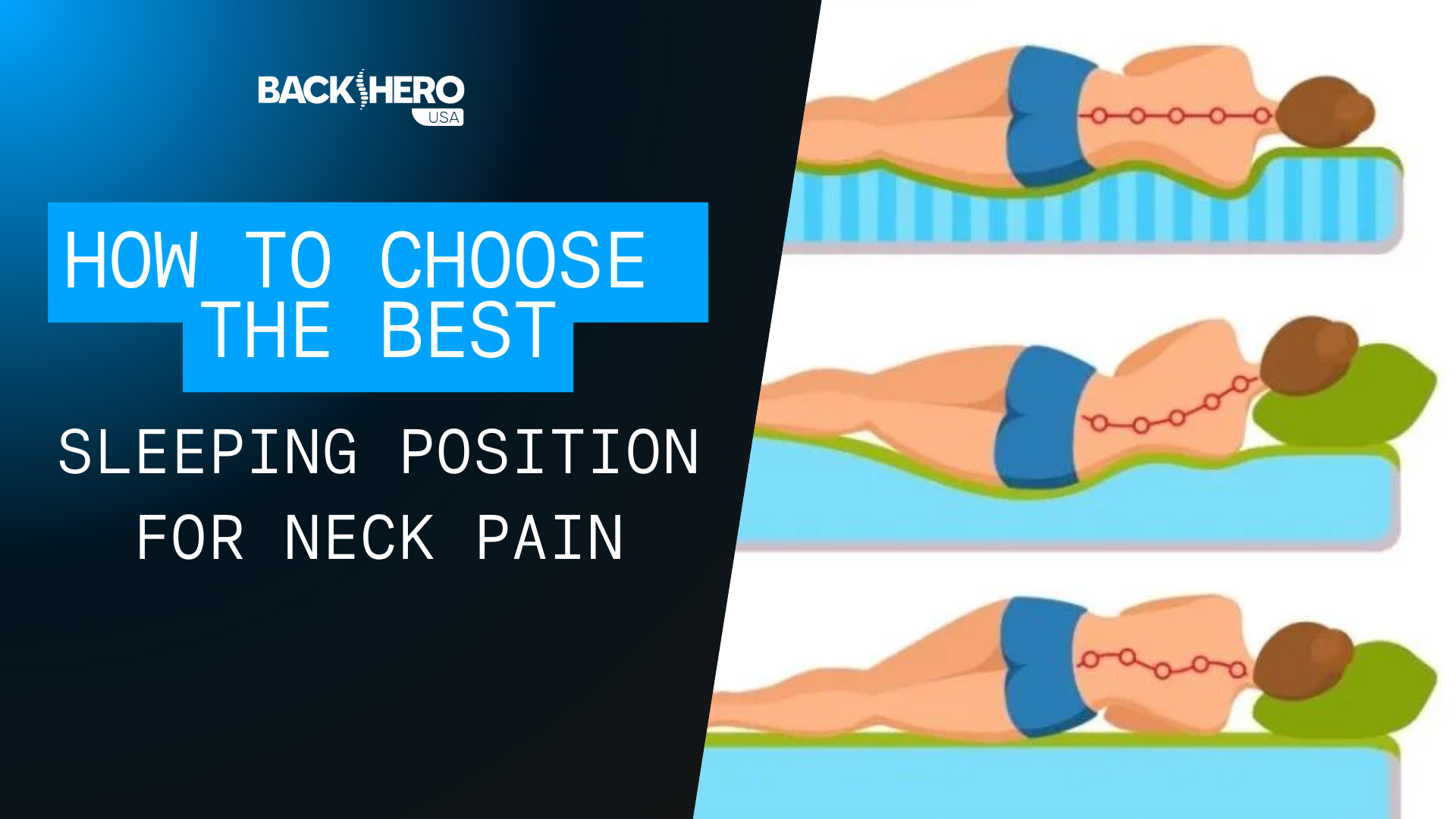 back-hero-usa-how-to-choose-the-best-sleeping-position-for-neck-pain