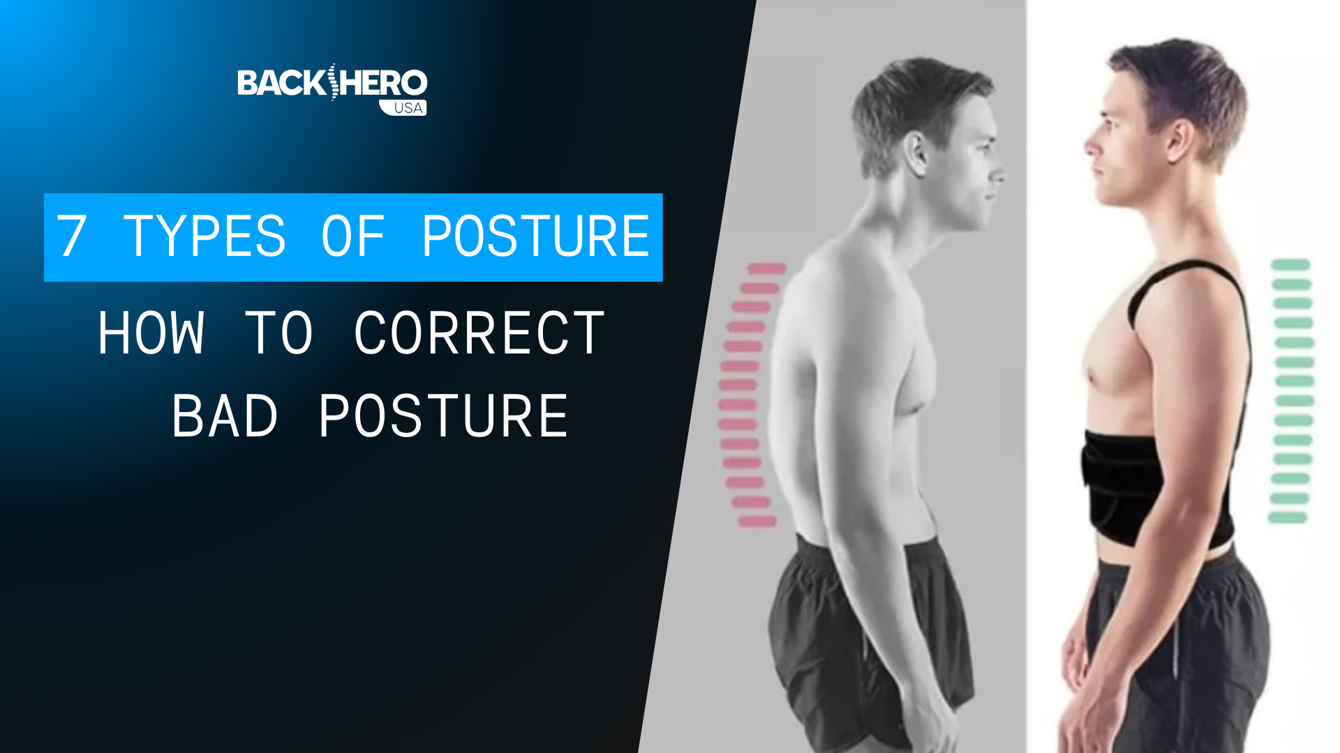 K Back Type 7 Types of Posture: How to Correct Bad Posture – Back Hero USA
