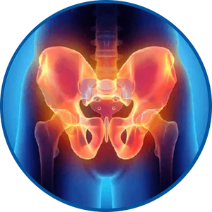 Hip Pain