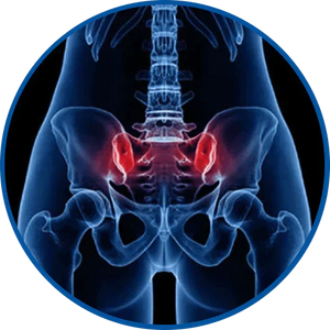 Pelvic Pain