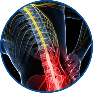 Chronic Back Pain