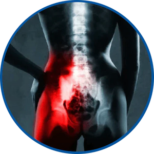 SI Joint Dysfunction