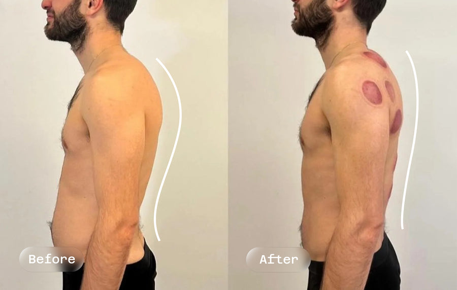 Before and after: posture