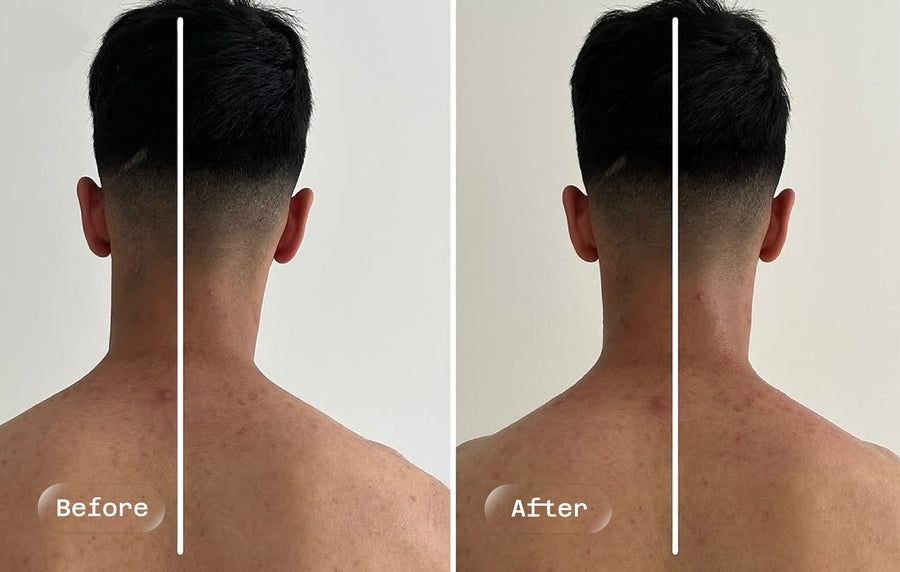 Before and after: neck