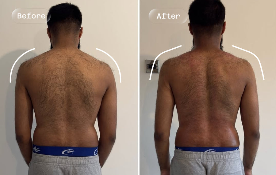 Before and after: back