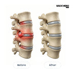 Back Hero USA Triple Fusion Massager