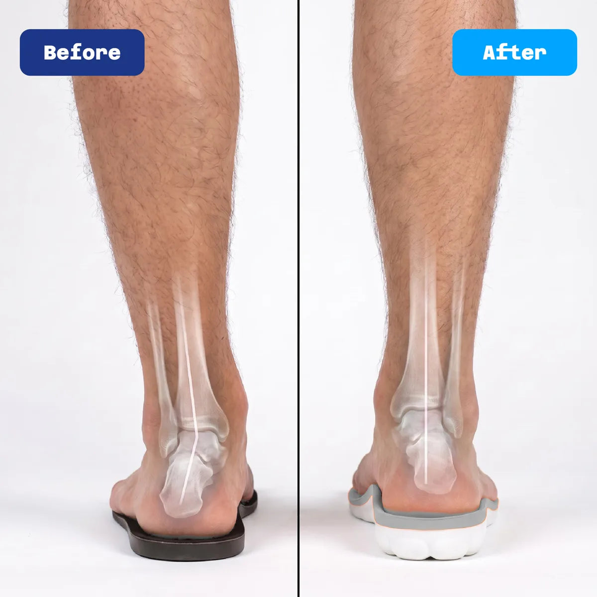 Before: heel on a flat sole. After: heel supported by the Cloud Massage Insoles